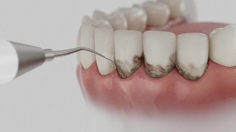 Trusted Dental Crowns And Bridges service in Menard, TX - Dentist Open Now
